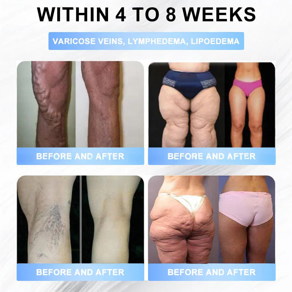 FDA Store | 𝐍𝐚𝐭𝐫𝐚𝐯𝐨𝐫™ 𝐒𝐥𝐢𝐦 & Firm 𝑁ano 𝑀icroneedle 𝑃atch with Collagen, Turmeric & Matrixyl 3000丨Obesity, Cardiovascular Disease, Diabetes, Sleep Apnea, Joint Problems and More