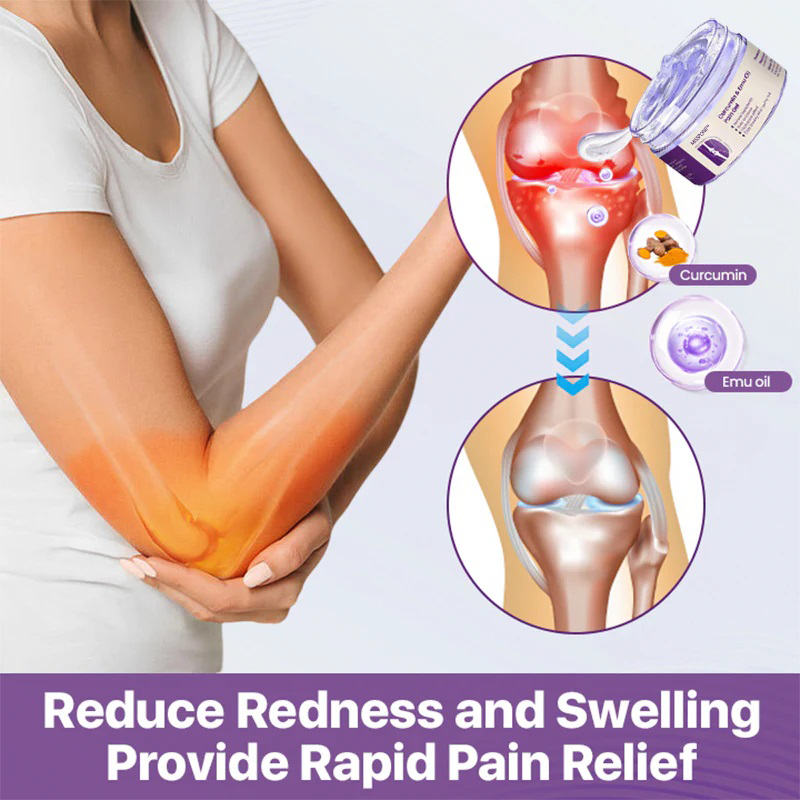 Misspone™ Curcumin & Emu Oil Pain Gel – 🏥Backed by US Osteopathic Experts