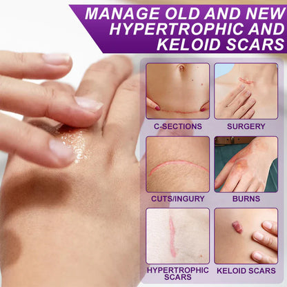 💙 UKCA-Certified ✅Misspone® Scar Gel – Clinically Proven to Fade Surgical, Acne, Burn & Trauma Scars