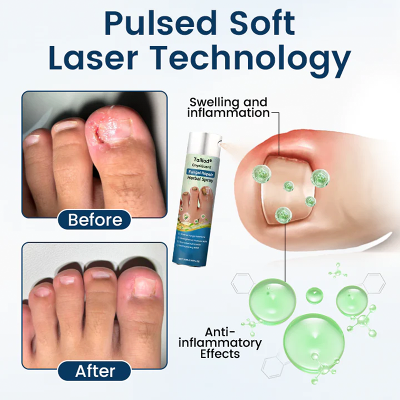 Taillod® OnyxiGuard Fungal Repair Herbal Spray