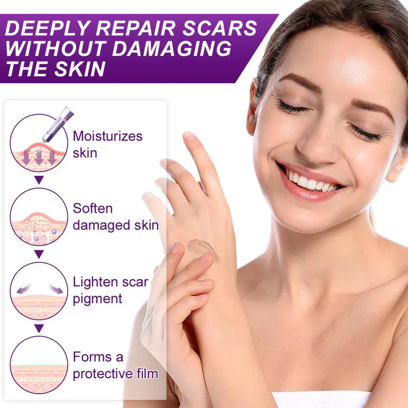💙 UKCA-Certified ✅Misspone® Scar Gel – Clinically Proven to Fade Surgical, Acne, Burn & Trauma Scars