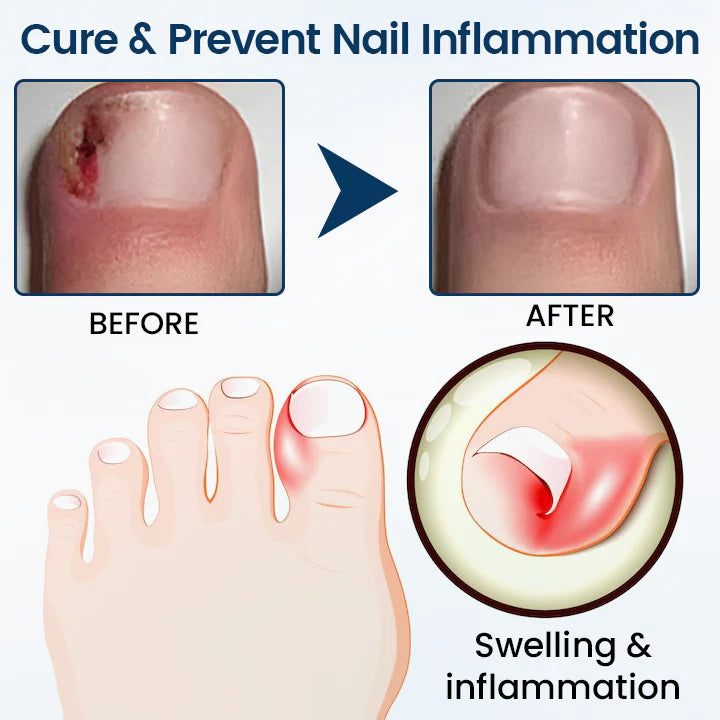 Taillod® OnyxiGuard Fungal Repair Herbal Spray