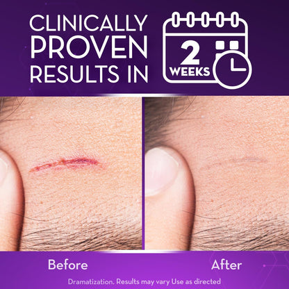 💙 UKCA-Certified ✅Misspone® Scar Gel – Clinically Proven to Fade Surgical, Acne, Burn & Trauma Scars
